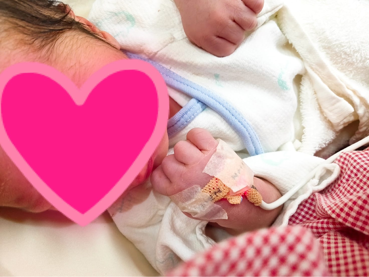 出産時に役立つインプリントポジション